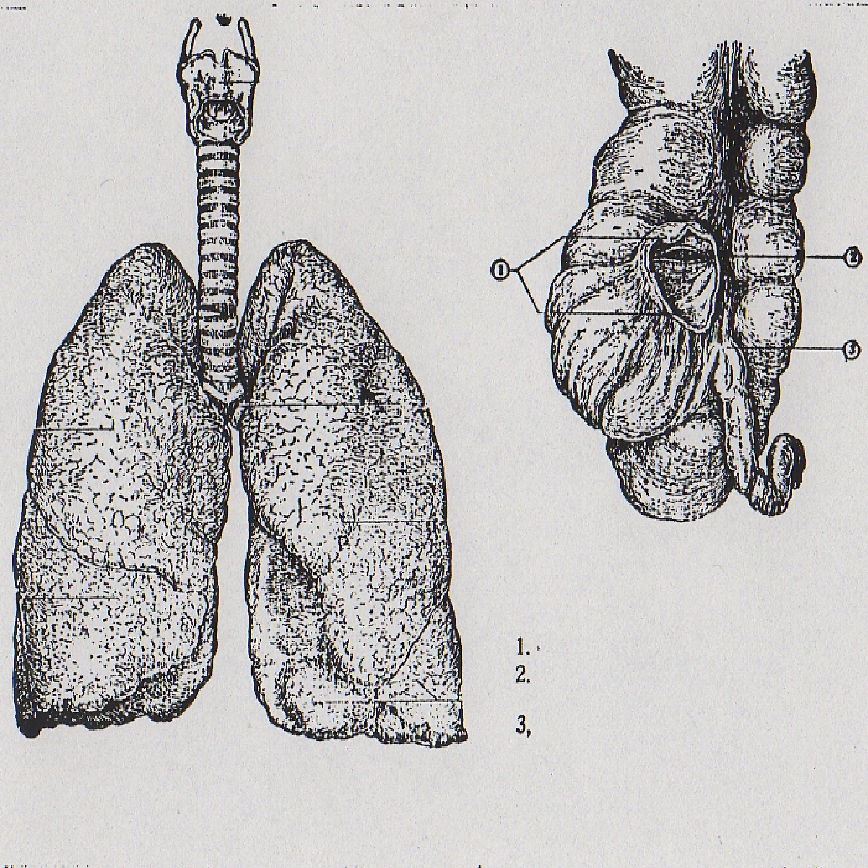 El Desvän del Macho - Tumor cerebral