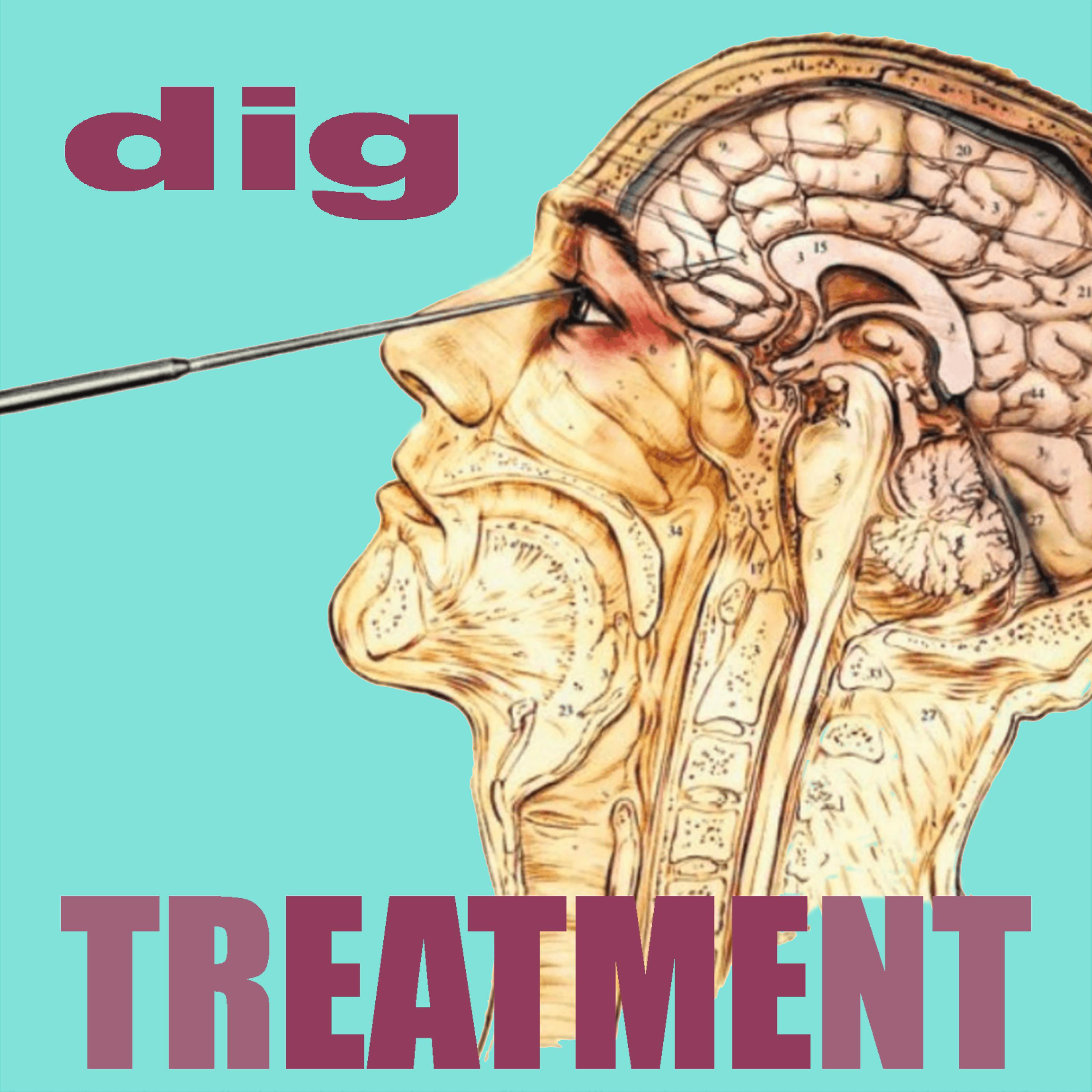 Постер альбома Treatment