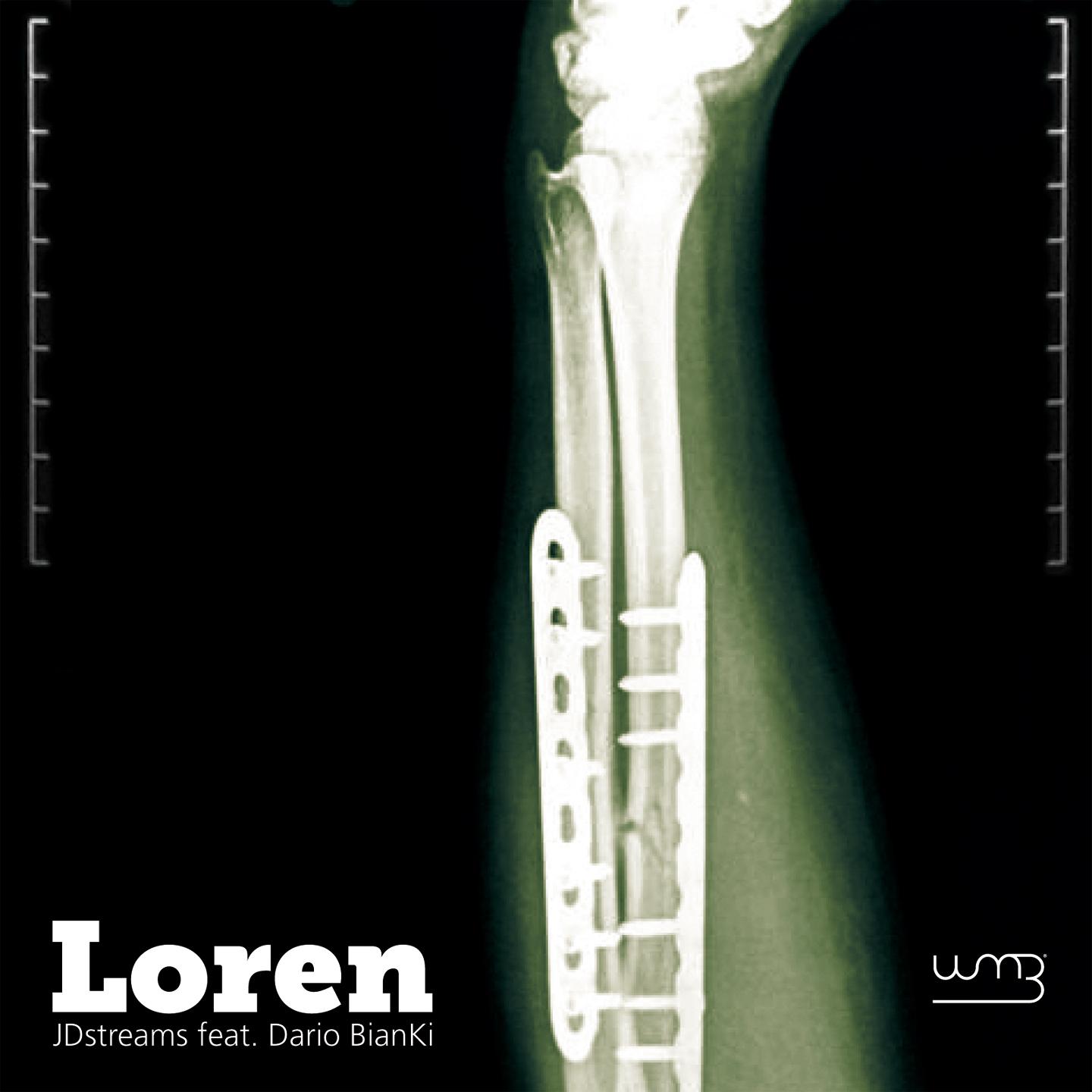 Постер альбома Loren