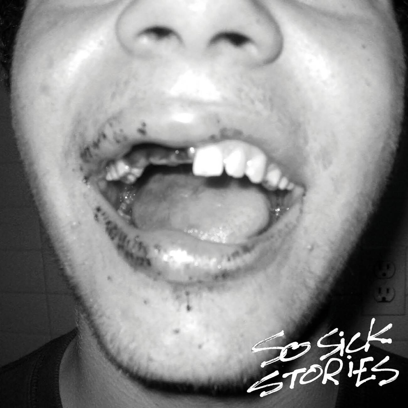 RATKING - So Sick Stories