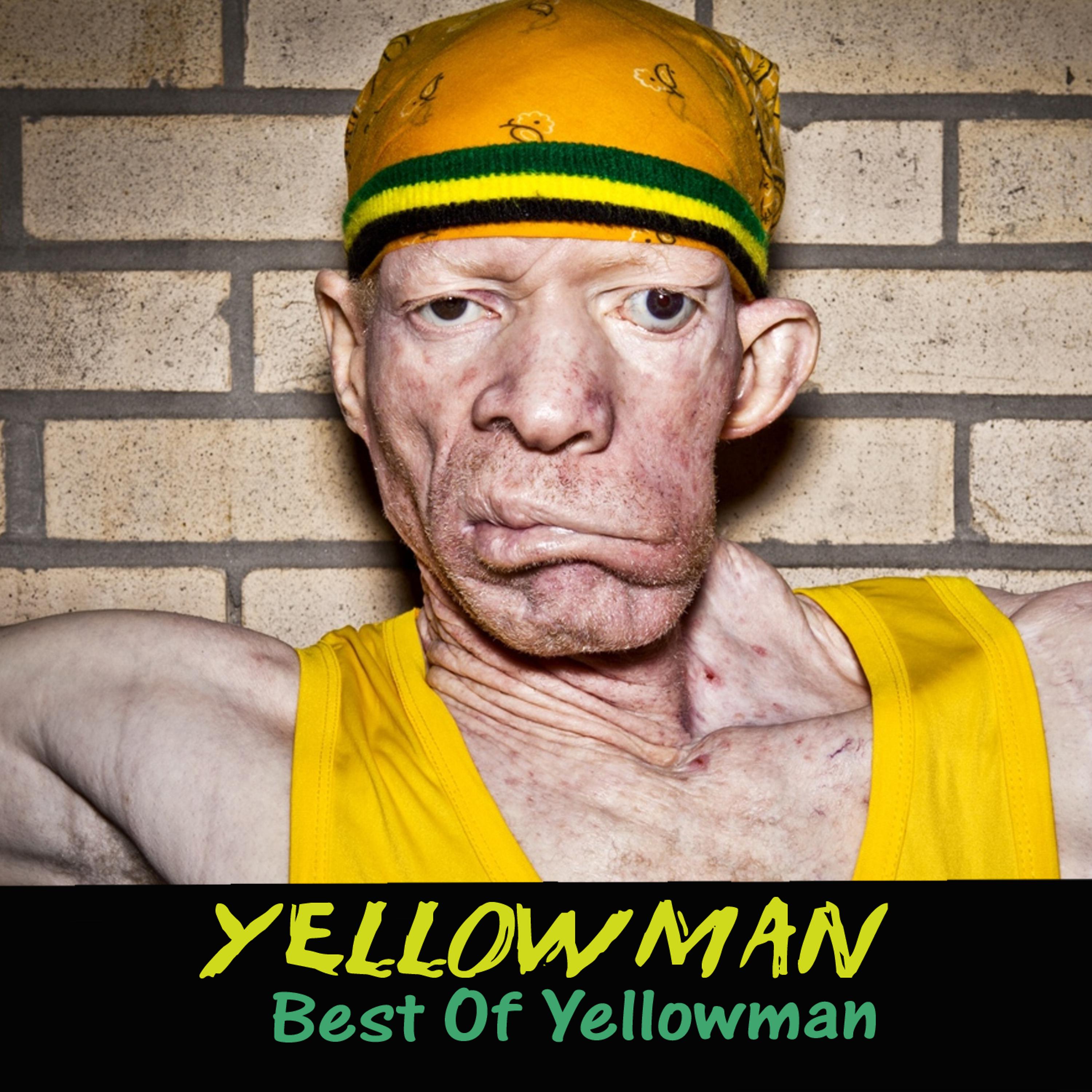 Постер альбома Best of Yellowman