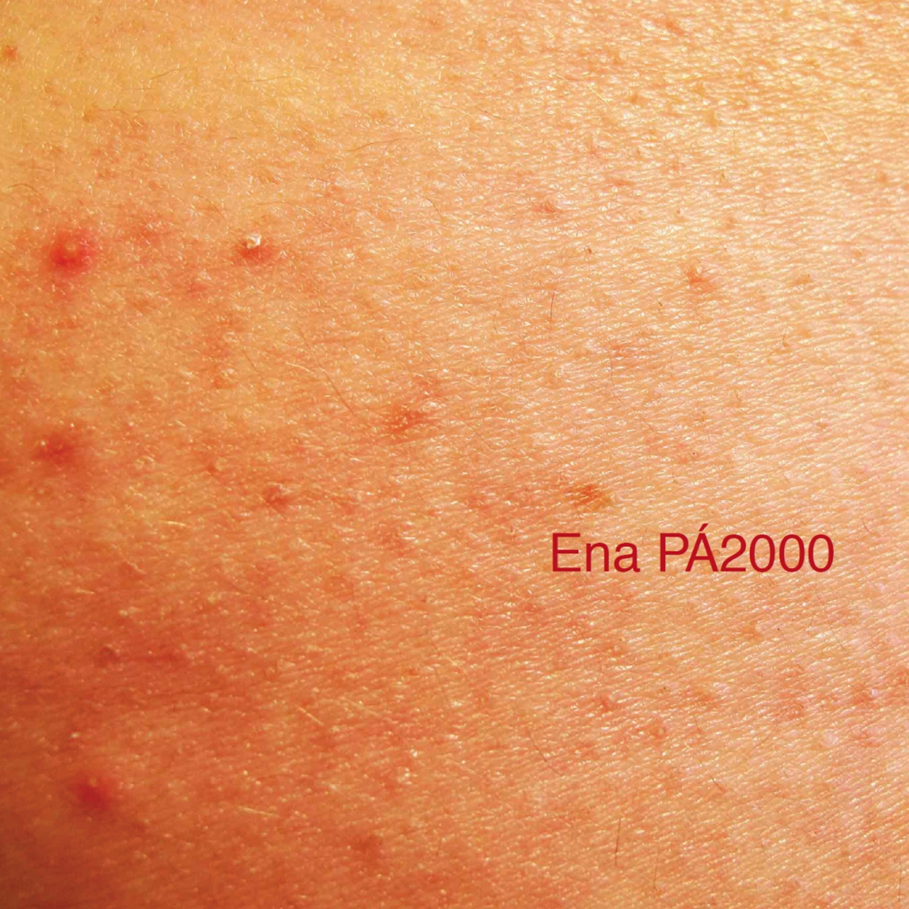 Ena Pá 2000 - Um Gajo Normal