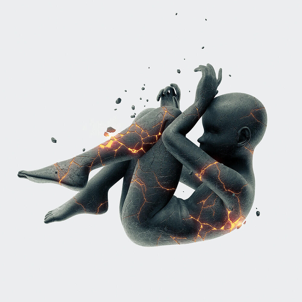 Arrhythmia - Planeta Alerta