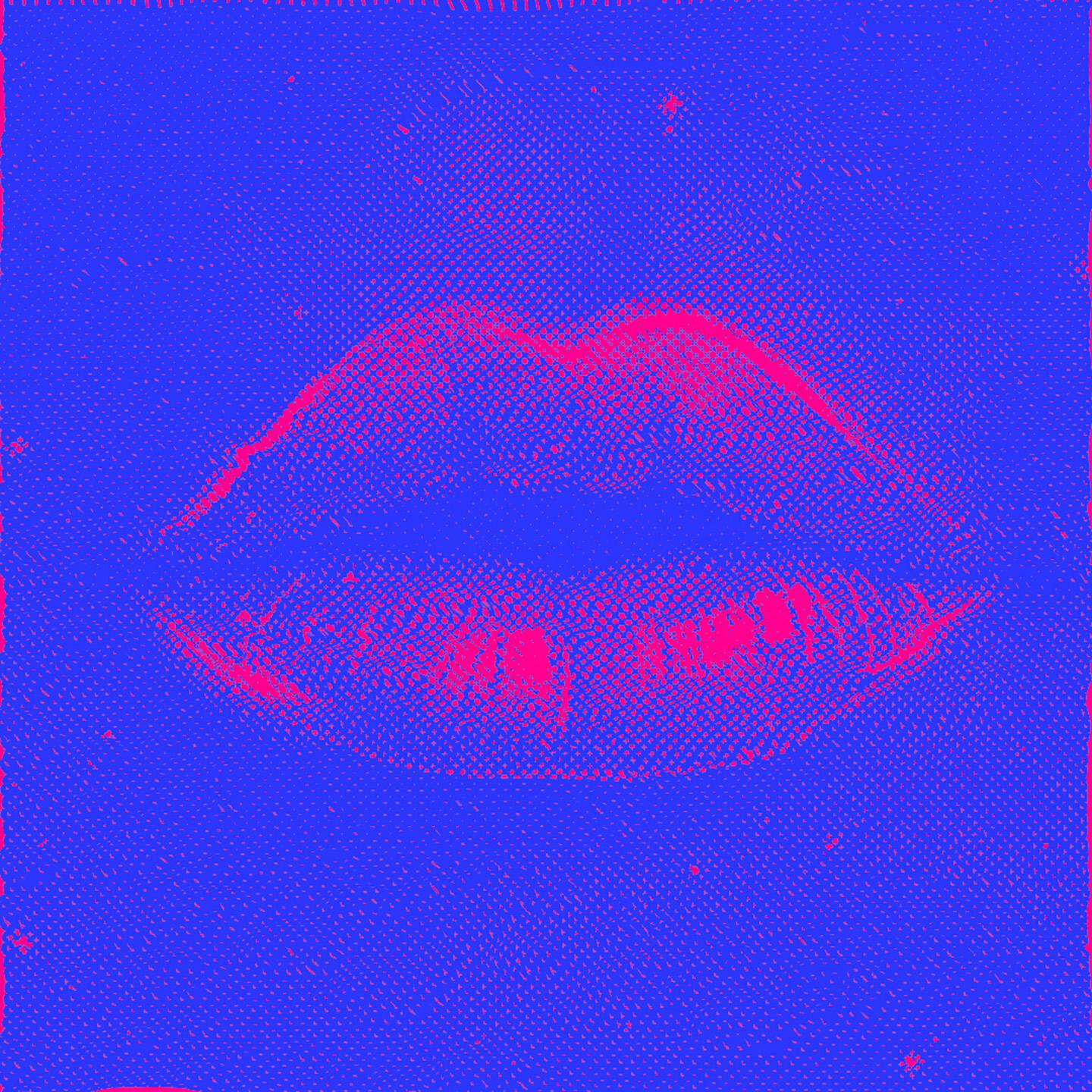 Постер альбома Ki-Ki-Kiss