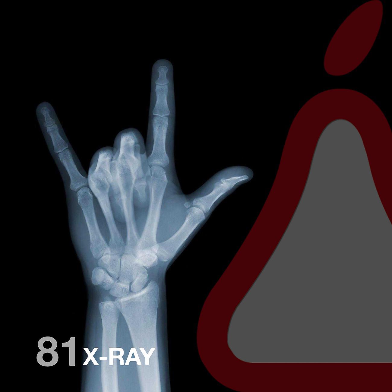Guille Placencia - X-Ray (DJ Dep Remix)