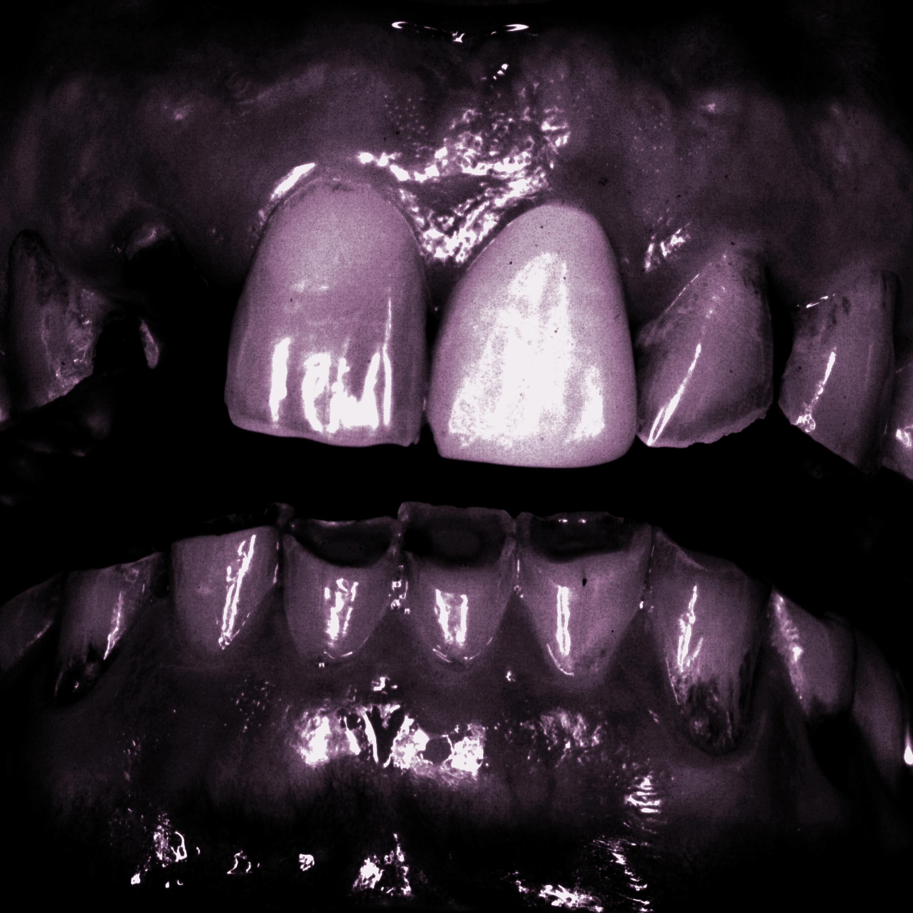 Постер альбома Grinding Teeth