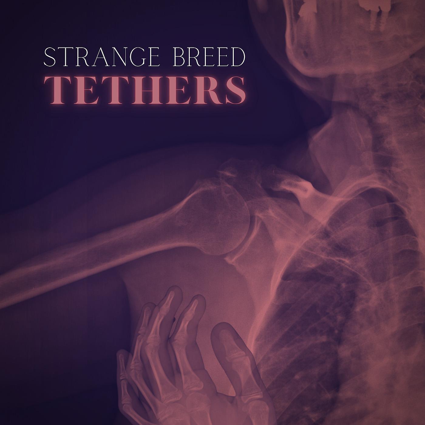 Постер альбома Tethers