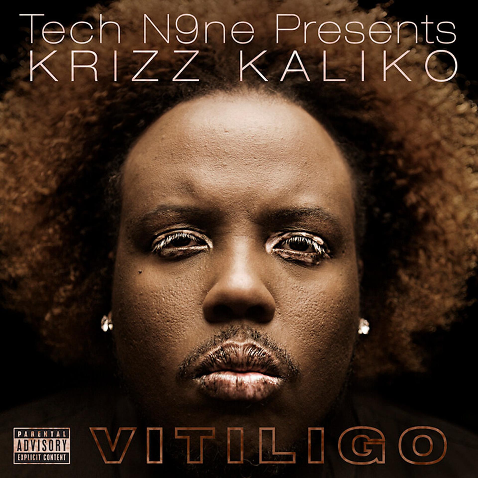 Постер альбома Vitiligo