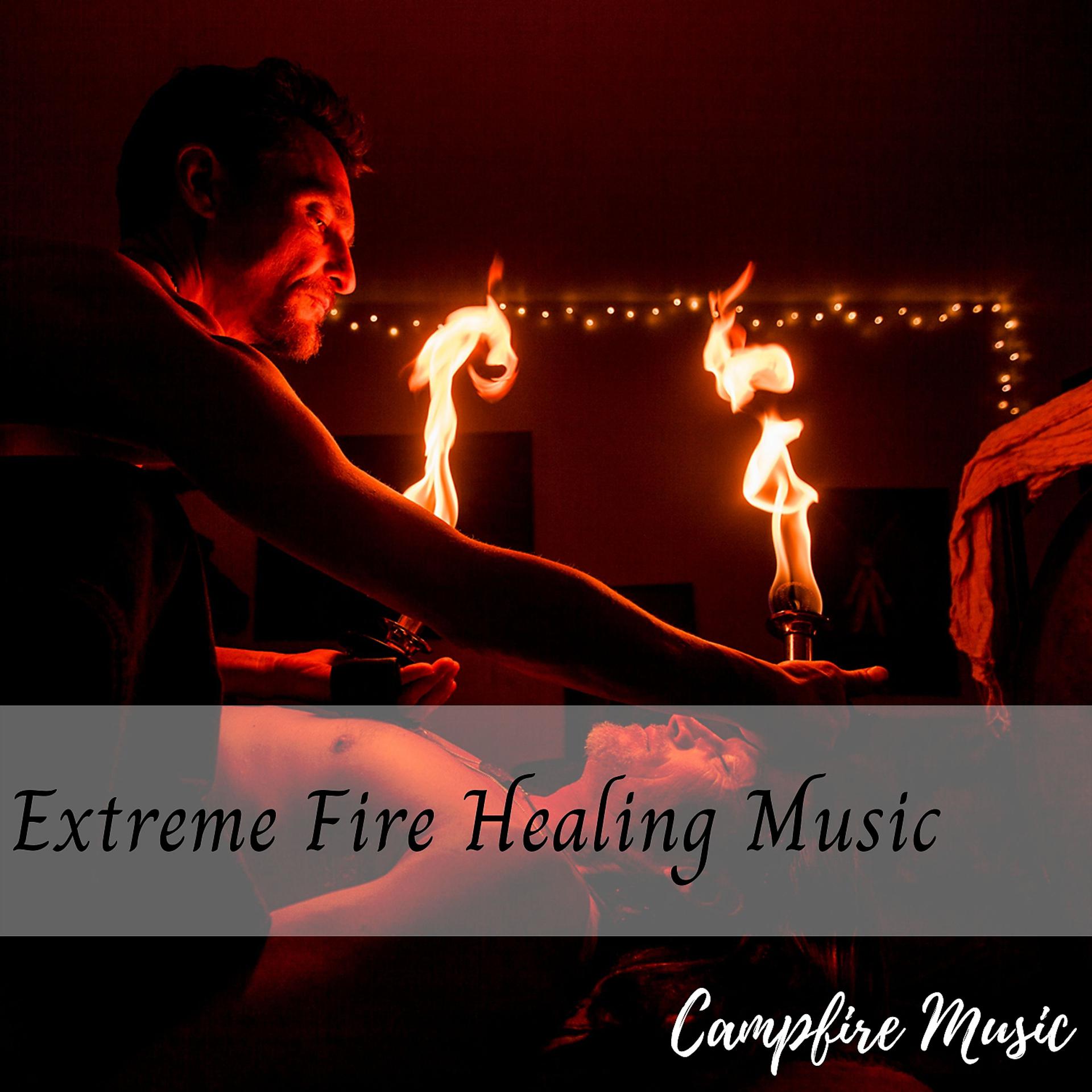 Постер альбома Campfire Music: Extreme Fire Healing Music