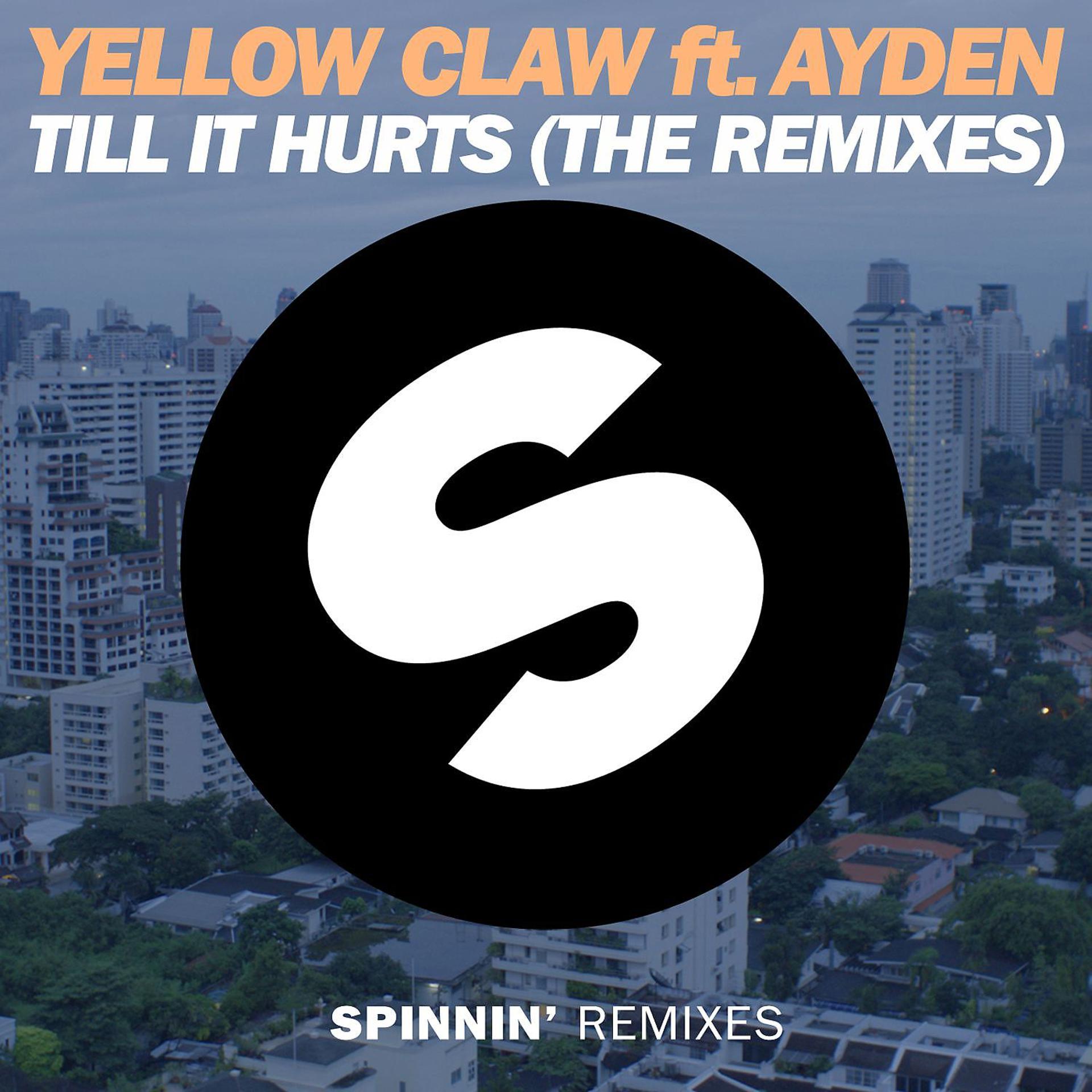 Постер альбома Till It Hurts (feat. Ayden) [The Remixes]