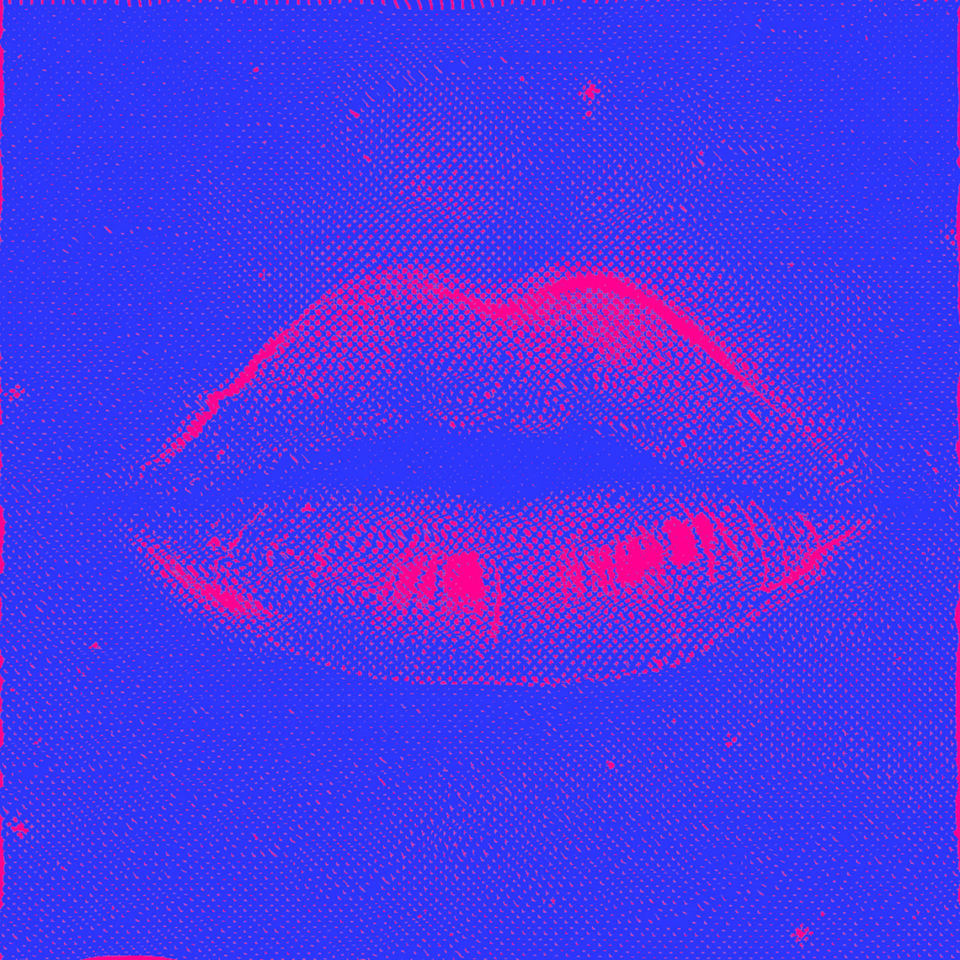 Постер альбома Ki-Ki-Kiss