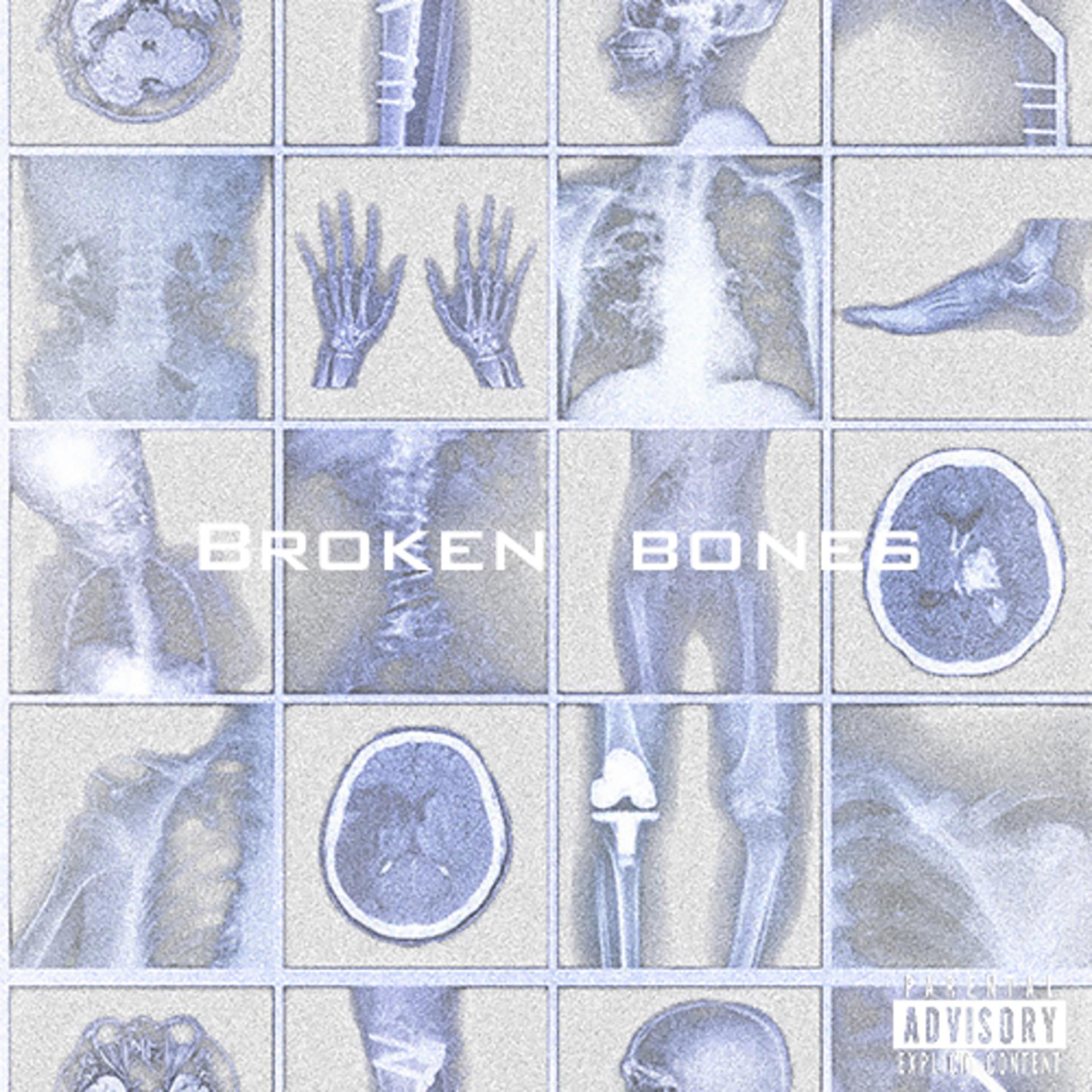 Постер альбома broken bones