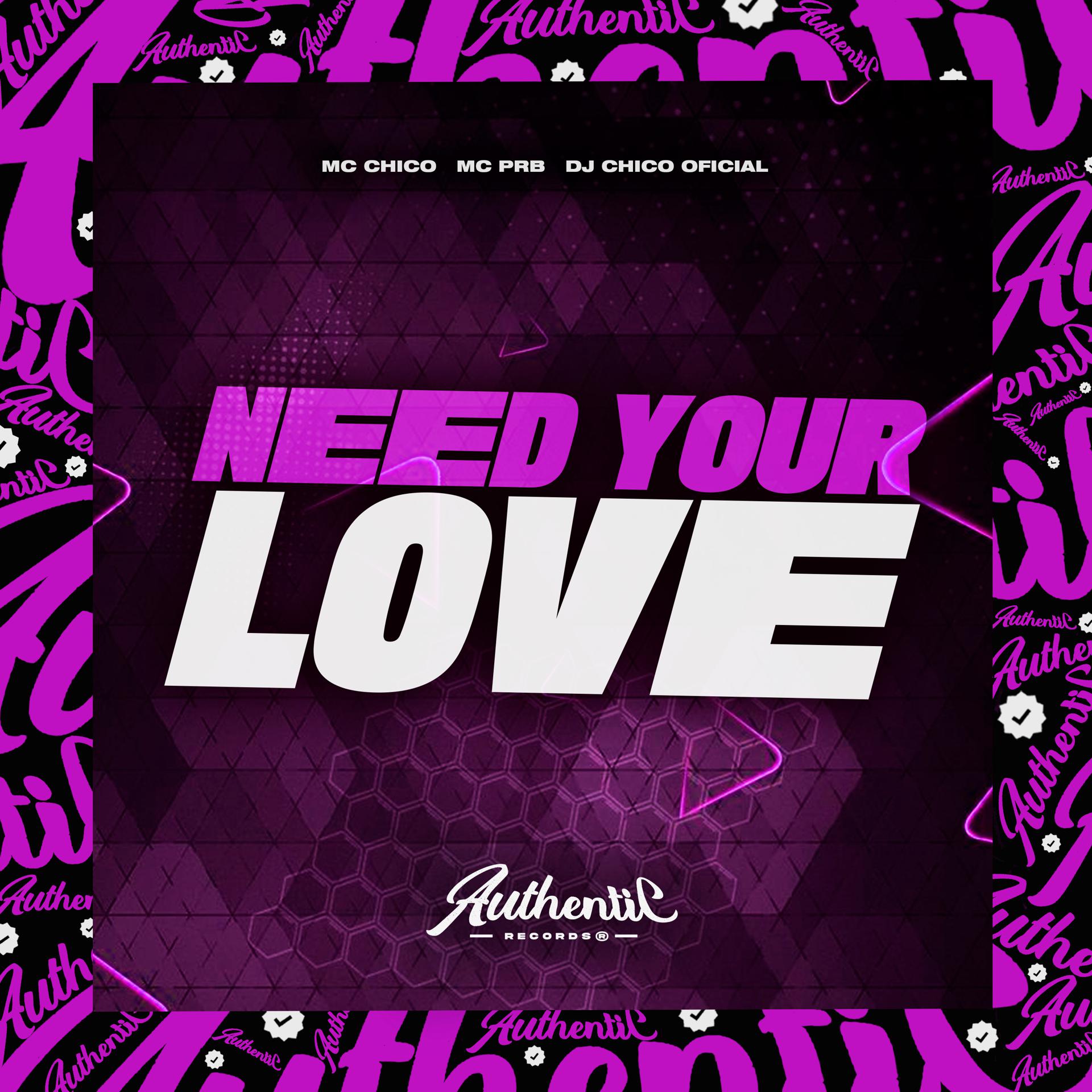 Постер альбома Need Your Love