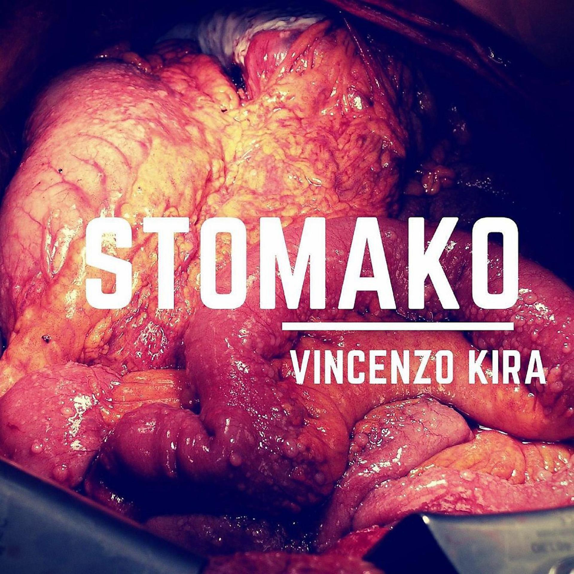 Постер альбома Stomaco